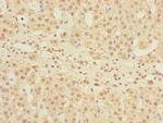 MPI Polyclonal Antibody