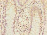 MPI Antibody in Immunohistochemistry (Paraffin) (IHC (P))
