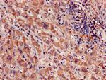MRPL3 Antibody in Immunohistochemistry (Paraffin) (IHC (P))