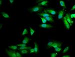 MVD Polyclonal Antibody