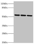 Myotilin Antibody in Western Blot (WB)