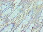 NCBP2 Polyclonal Antibody