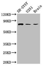 NCDN Antibody in Western Blot (WB)