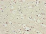 NDUFB10 Polyclonal Antibody