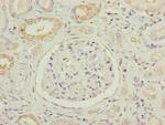 NDUFB5 Antibody in Immunohistochemistry (Paraffin) (IHC (P))