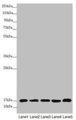 NDUFB5 Antibody in Western Blot (WB)
