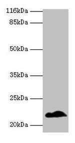 NDUFB5 Polyclonal Antibody