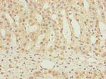NDUFS6 Polyclonal Antibody