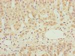 NDUFS6 Polyclonal Antibody