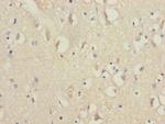 NDUFV1 Antibody in Immunohistochemistry (Paraffin) (IHC (P))