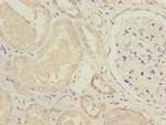 NDUFV1 Polyclonal Antibody
