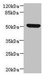 NDUFV1 Antibody in Western Blot (WB)