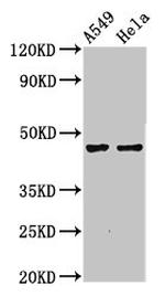 NMBR Polyclonal Antibody