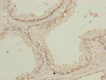 NMT2 Polyclonal Antibody