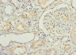NNMT Polyclonal Antibody
