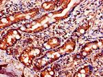 NOL10 Antibody in Immunohistochemistry (Paraffin) (IHC (P))