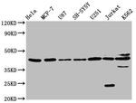 NPY2R Antibody in Western Blot (WB)