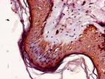 NR2C2AP Antibody in Immunohistochemistry (Paraffin) (IHC (P))