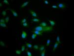 Nardilysin Polyclonal Antibody