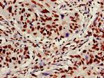 Ku70 Antibody in Immunohistochemistry (Paraffin) (IHC (P))