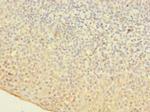 OGG1 Polyclonal Antibody