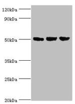 ORC4 Antibody in Western Blot (WB)