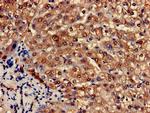 PCCA Polyclonal Antibody