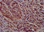 PCCB Polyclonal Antibody
