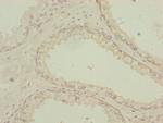 PDHA2 Polyclonal Antibody