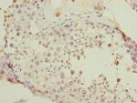PDHA2 Antibody in Immunohistochemistry (Paraffin) (IHC (P))
