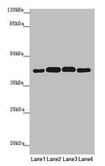 PDHA2 Antibody in Western Blot (WB)