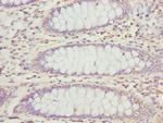 PECR Polyclonal Antibody