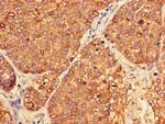 PER3 Antibody in Immunohistochemistry (Paraffin) (IHC (P))