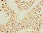 PGAM2 Polyclonal Antibody