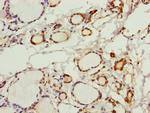 PGLS Polyclonal Antibody