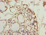 PGLS Polyclonal Antibody