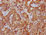 PHACTR1 Antibody in Immunohistochemistry (Paraffin) (IHC (P))