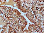 PHACTR1 Antibody in Immunohistochemistry (Paraffin) (IHC (P))