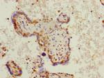 PHF11 Polyclonal Antibody