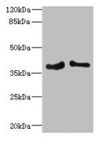 PHF11 Antibody in Western Blot (WB)