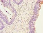 PHKG2 Polyclonal Antibody