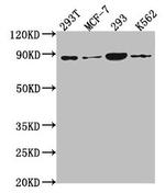 PLA2G4B Antibody in Western Blot (WB)