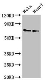 PLS3 Antibody in Western Blot (WB)