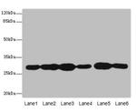 PMM2 Antibody in Western Blot (WB)