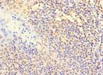 POLB Polyclonal Antibody