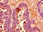 POLR2C Antibody in Immunohistochemistry (Paraffin) (IHC (P))