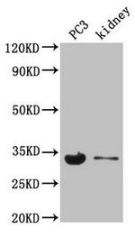 POLR2C Antibody in Western Blot (WB)