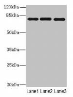 PPEF1 Antibody in Western Blot (WB)