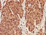 PP1 beta Antibody in Immunohistochemistry (Paraffin) (IHC (P))