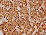 PP5 Antibody in Immunohistochemistry (Paraffin) (IHC (P))